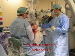 Primero tratar la
hidrocefalia
 