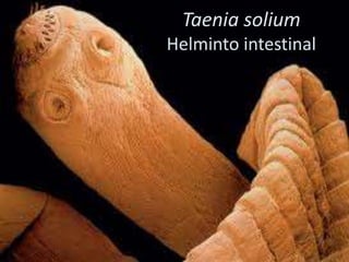 Taenia solium
Helminto intestinal
 