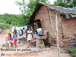 Endémica en países
de bajo desarrollo social
 