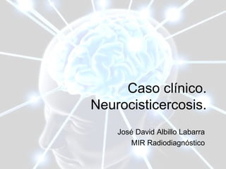 Caso clínico.
Neurocisticercosis.
José David Albillo Labarra
MIR Radiodiagnóstico
 