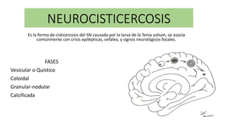 NEUROCISTICERCOSIS
Es la forma de cisticercosis del SN causada por la larva de la Tenia solium, se asocia
comúnmente con crisis epilépticas, cefalea, y signos neurológicos focales.
FASES
Vesicular o Quístico
Coloidal
Granular-nodular
Calcificada
 