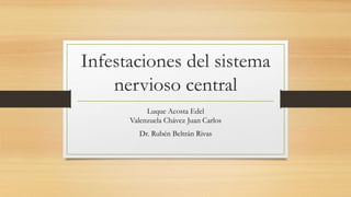 Infestaciones del sistema
nervioso central
Luque Acosta Edel
Valenzuela Chávez Juan Carlos
Dr. Rubén Beltrán Rivas
 