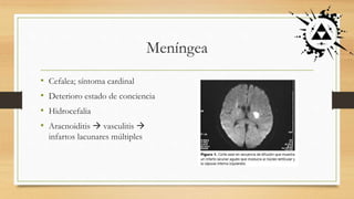 Meníngea
• Cefalea; síntoma cardinal
• Deterioro estado de conciencia
• Hidrocefalia
• Aracnoiditis  vasculitis 
infartos lacunares múltiples
 