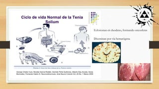 Eclosionan en duodeno, formando oncosferas
Diseminan por vía hematógena
 