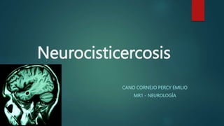 Neurocisticercosis
CANO CORNEJO PERCY EMILIO
MR1 - NEUROLOGÍA
 