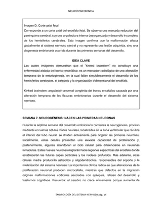 NEUROCONFERENCIA
EMBRIOLOGÍA DEL SISTEMA NERVIOSO pág. 14
Imagen D. Corte axial fetal
Corresponde a un corte axial del encéfalo fetal. Se observa una marcada reducción del
parénquima cerebral, con una arquitectura interna desorganizada y desarrollo incompleto
de los hemisferios cerebrales. Esta imagen confirma que la malformación afecta
globalmente al sistema nervioso central y no representa una lesión adquirida, sino una
disgenesia embrionaria ocurrida durante las primeras semanas del desarrollo.
IDEA CLAVE
Las cuatro imágenes demuestran que el "kinked brainstem" no constituye una
enfermedad aislada del tronco encefálico; es un marcador radiológico de una alteración
temprana de la embriogénesis, en la cual fallan simultáneamente el desarrollo de los
hemisferios cerebrales, el cerebelo y la organización tridimensional del encéfalo.
Kinked brainstem: angulación anormal congénita del tronco encefálico causada por una
alteración temprana de las flexuras embrionarias durante el desarrollo del sistema
nervioso.
SEMANA 7. NEUROGÉNESIS: NACEN LAS PRIMERAS NEURONAS
Durante la séptima semana del desarrollo embrionario comienza la neurogénesis, proceso
mediante el cual las células madre neurales, localizadas en la zona ventricular que recubre
el interior del tubo neural, se dividen activamente para originar las primeras neuronas.
Inicialmente, estas células presentan una elevada capacidad de proliferación y,
posteriormente, algunas abandonan el ciclo celular para diferenciarse en neuronas
inmaduras. Estas nuevas neuronas migrarán hacia regiones específicas del encéfalo donde
establecerán las futuras capas corticales y los núcleos profundos. Más adelante, otras
células madre producirán astrocitos y oligodendrocitos, responsables del soporte y la
mielinización del sistema nervioso. La importancia clínica radica en que alteraciones de la
proliferación neuronal producen microcefalia, mientras que defectos en la migración
originan malformaciones corticales asociadas con epilepsia, retraso del desarrollo y
trastornos cognitivos. Recuerda: el cerebro no crece únicamente porque aumenta de
 