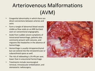 Arteriovenous Malformations (AVM) Congenital abnormality in which there are direct connections between arteries and veins Form a tangle of abnormal blood vessels visible as flow voids on an MRI but best seen on conventional angiography. Aside from sudden severe symptoms of intracranial hemorrhage, patients also commonly present with seizures, and migraine like headaches in the absence of hemorrhage. Hemorrhage is usually intraparenchymal but can extend into the intraventricular or subarachnoid space as well.  The risk of rebleeding is 1%-4% per year, lower than in aneurismal hemorrhage. Treatments include neurosurgical removal, intravascular embolization, and stereotactic radiosurgery. 