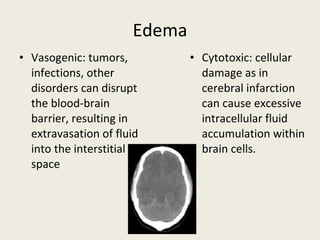 Edema Vasogenic: tumors, infections, other disorders can disrupt the blood-brain barrier, resulting in extravasation of fluid into the interstitial space Cytotoxic: cellular damage as in cerebral infarction can cause excessive intracellular fluid accumulation within brain cells.  
