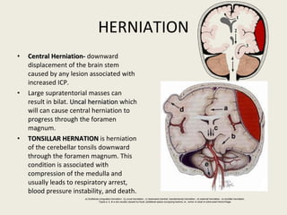 HERNIATION Central Herniation-  downward displacement of the brain stem caused by any lesion associated with increased ICP. Large supratentorial masses can result in bilat.  Uncal herniation  which will can cause central herniation to progress through the foramen magnum. TONSILLAR HERNATION  is herniation of the cerebellar tonsils downward through the foramen magnum. This condition is associated with compression of the medulla and usually leads to respiratory arrest, blood pressure instability, and death.  a) Subfalcial (cingulate) herniation ; b) uncal herniation ; c) downward (central, transtentorial) herniation ; d) external herniation ; e) tonsillar herniation. Types a, b, & e are usually caused by focal, ipsilateral space occupying lesions, ie., tumor or axial or extra-axial hemorrhage. 