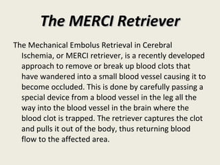 The MERCI Retriever The Mechanical Embolus Retrieval in Cerebral Ischemia, or MERCI retriever, is a recently developed approach to remove or break up blood clots that have wandered into a small blood vessel causing it to become occluded. This is done by carefully passing a special device from a blood vessel in the leg all the way into the blood vessel in the brain where the blood clot is trapped. The retriever captures the clot and pulls it out of the body, thus returning blood flow to the affected area. 
