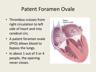 Patent Foramen Ovale Thrombus crosses from right circulation to left side of heart and into cerebral circ. A patent foramen ovale (PFO) allows blood to bypass the lungs.  In about 1 out of 3 or 4 people, the opening never closes. 