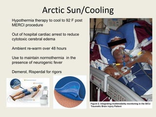 Arctic Sun/Cooling Hypothermia therapy to cool to 92 F post MERCI procedure Out of hospital cardiac arrest to reduce cytotoxic cerebral edema Ambient re-warm over 48 hours Use to maintain normothermia  in the presence of neurogenic fever Demerol, Risperdal for rigors 
