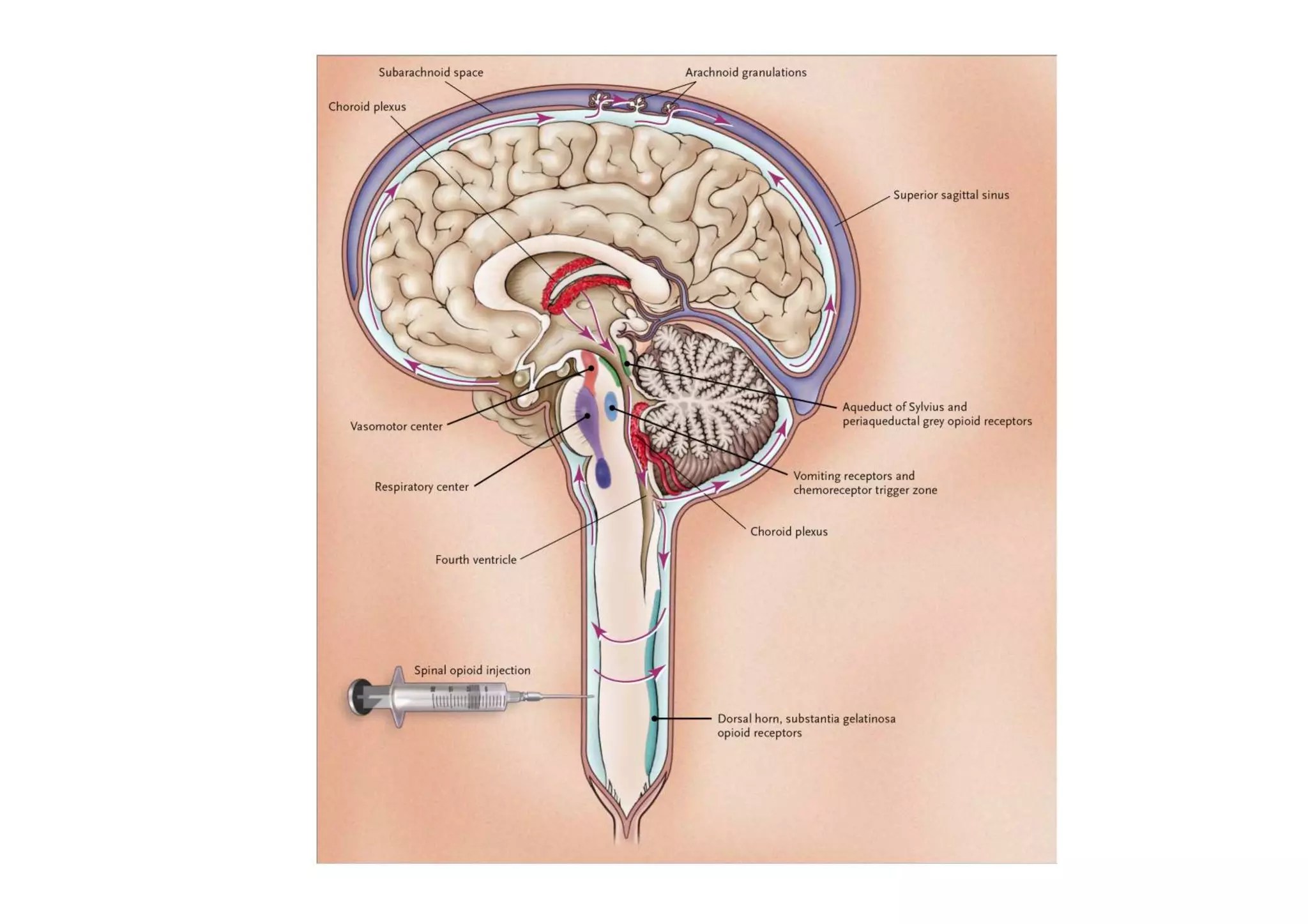 CONTINUUM NEUROCRITICAL CARE PDF visual data 6