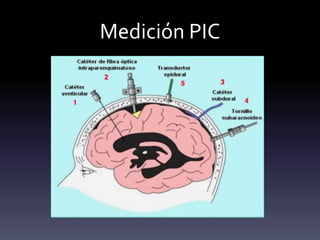 Medición PIC
 