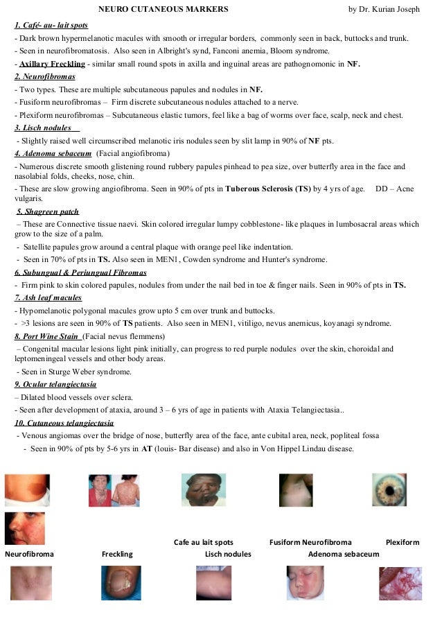 Neurocutaneous markers