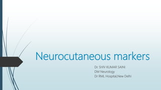 Neurocutaneous markers
Dr. SHIV KUMAR SAINI
DM Neurology
Dr RML Hospital,New Delhi
 