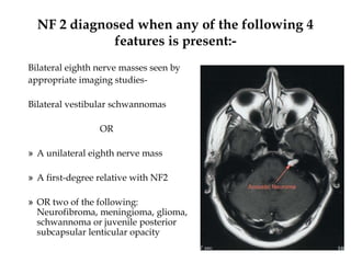 NF 2 diagnosed when any of the following 4
features is present:-
Bilateral eighth nerve masses seen by
appropriate imaging studies-
Bilateral vestibular schwannomas
OR
» A unilateral eighth nerve mass
» A first-degree relative with NF2
» OR two of the following:
Neurofibroma, meningioma, glioma,
schwannoma or juvenile posterior
subcapsular lenticular opacity
 