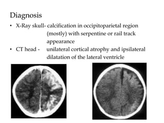 Diagnosis
• X-Ray skull- calcification in occipitoparietal region
(mostly) with serpentine or rail track
appearance
• CT head - unilateral cortical atrophy and ipsilateral
dilatation of the lateral ventricle
 