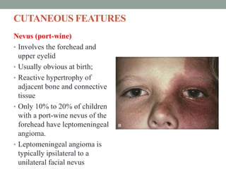 CUTANEOUS FEATURES
Nevus (port-wine)
• Involves the forehead and
upper eyelid
• Usually obvious at birth;
• Reactive hypertrophy of
adjacent bone and connective
tissue
• Only 10% to 20% of children
with a port-wine nevus of the
forehead have leptomeningeal
angioma.
• Leptomeningeal angioma is
typically ipsilateral to a
unilateral facial nevus
 