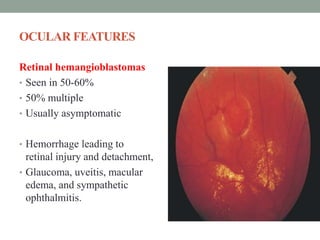 OCULAR FEATURES
Retinal hemangioblastomas
• Seen in 50-60%
• 50% multiple
• Usually asymptomatic
• Hemorrhage leading to
retinal injury and detachment,
• Glaucoma, uveitis, macular
edema, and sympathetic
ophthalmitis.
 