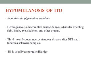 HYPOMELANOSIS OF ITO
• Incontinentia pigmenti achromians
• Heterogeneous and complex neurocutaneous disorder affecting
skin, brain, eye, skeleton, and other organs.
• Third most frequent neurocutaneous disease after NF1 and
tuberous sclerosis complex.
• HI is usually a sporadic disorder
 