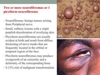 Neurocutaneous Syndrome