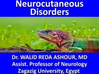 Neurocutaneous
Disorders
Dr. WALID REDA ASHOUR, MD
Assist. Professor of Neurology
Zagazig University, Egypt
 