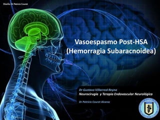 Vasoespasmo Post-HSA
(Hemorragia Subaracnoidea)



   Dr Gustavo Villarreal Reyna
   Neurocirugía y Terapia Endovascular Neurológica

   Dr Patricio Couret Alcaraz
 
