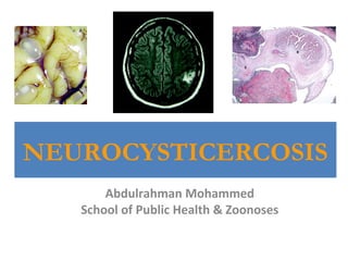 NEUROCYSTICERCOSIS 
Abdulrahman Mohammed 
School of Public Health & Zoonoses 
 