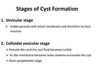 1. Vesicular stage
 Viable parasite with intact membrane and therefore no host
reaction
2. Colloidal vesicular stage
Parasite dies and the cyst fluid becomes turbid
 As the membrane becomes leaky oedema surrounds the cyst
Most symptomatic stage
Stages of Cyst Formation
 