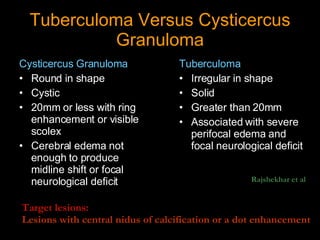 Tuberculoma Versus Cysticercus Granuloma Cysticercus Granuloma Round in shape Cystic 20mm or less with ring enhancement or visible scolex Cerebral edema not enough to produce midline shift or focal neurological deficit Tuberculoma Irregular in shape Solid Greater than 20mm Associated with severe perifocal edema and focal neurological deficit Rajshekhar et al Target lesions:  Lesions with central nidus of calcification or a dot enhancement 