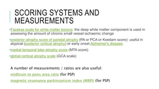 SCORING SYSTEMS AND
MEASUREMENTS
•Fazekas scale for white matter lesions: the deep white matter component is used in
assessing the amount of chronic small vessel ischaemic change
•posterior atrophy score of parietal atrophy (PA or PCA or Koedam score): useful in
atypical (posterior cortical atrophy) or early onset Alzheimer's disease.
•medial temporal lobe atrophy score (MTA score)
•global cortical atrophy scale (GCA scale)
A number of measurements / ratios are also useful:
midbrain to pons area ratio (for PSP)
magnetic resonance parkinsonism index (MRPI) (for PSP)
 