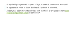 In a patient younger than 75 years of age, a score of 2 or more is abnormal.
In a patient 75 years or older, a score of 3 or more is abnormal.
Atrophy has been shown to correlate with likelihood of progression from mild
cognitive impairment (MCI) to dementia 4.
 