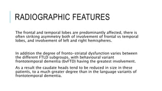 RADIOGRAPHIC FEATURES
The frontal and temporal lobes are predominantly affected, there is
often striking asymmetry both of involvement of frontal vs temporal
lobes, and involvement of left and right hemispheres.
In addition the degree of fronto-striatal dysfunction varies between
the different FTLD subgroups, with behavioural variant
frontotemporal dementia (bvFTD) having the greatest involvement.
As a result the caudate heads tend to be reduced in size in these
patients, to a much greater degree than in the language variants of
frontotemporal dementia.
 