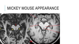 MICKEY MOUSE APPEARANCE
 