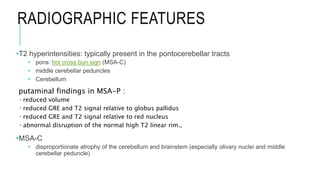 RADIOGRAPHIC FEATURES
•T2 hyperintensities: typically present in the pontocerebellar tracts
• pons: hot cross bun sign (MSA-C)
• middle cerebellar peduncles
• Cerebellum
putaminal findings in MSA-P :
 reduced volume
 reduced GRE and T2 signal relative to globus pallidus
 reduced GRE and T2 signal relative to red nucleus
 abnormal disruption of the normal high T2 linear rim.,
•MSA-C
• disproportionate atrophy of the cerebellum and brainstem (especially olivary nuclei and middle
cerebellar peduncle)
 