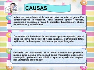 CAUSAS
 