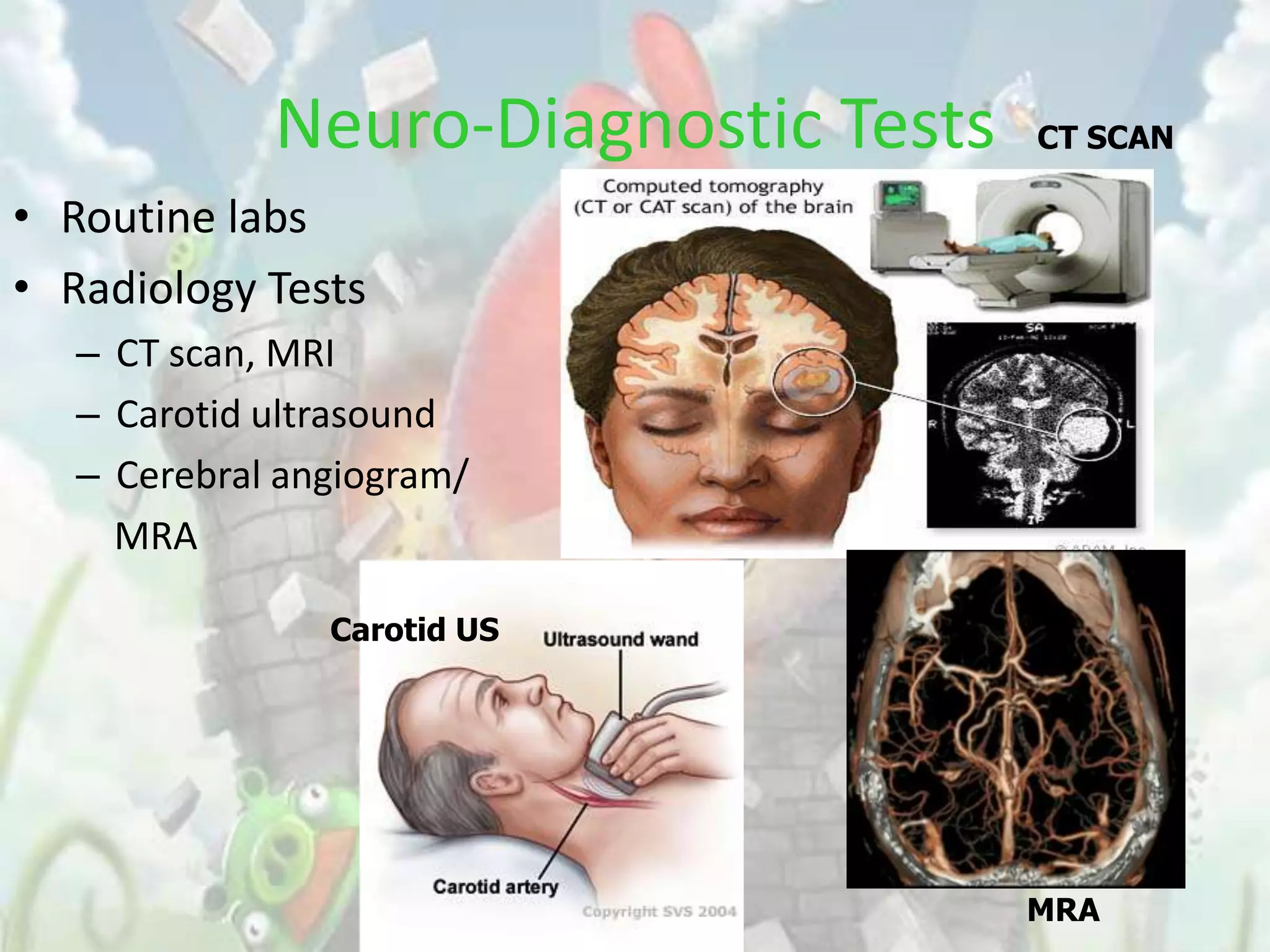 Neuro-Diagnostic Tests   CT SCAN

• Routine labs
• Radiology Tests
   – CT scan, MRI
   – Carotid ultrasound
   – Cerebral angiogram/
     MRA

                Carotid US




                                      MRA
 