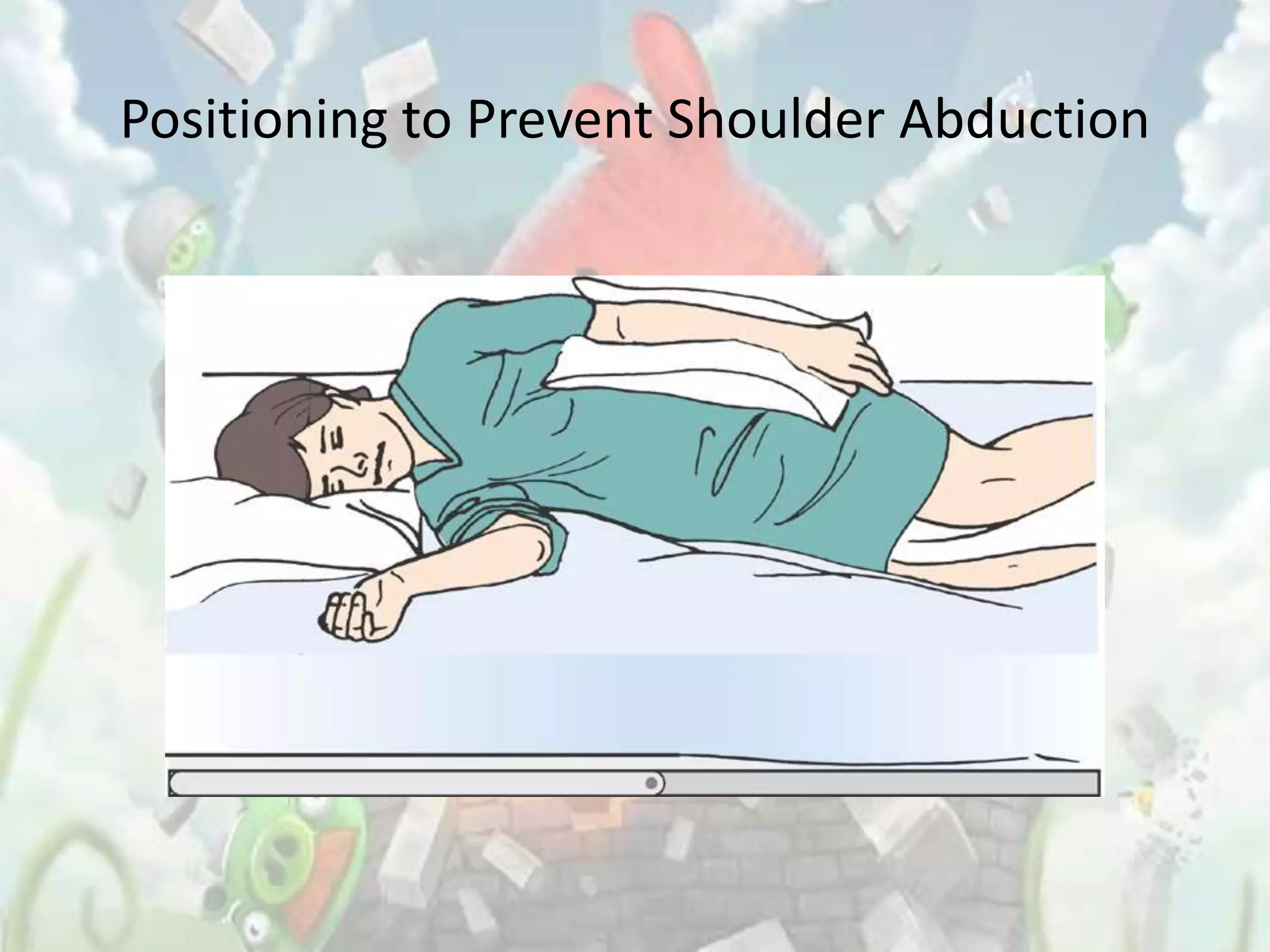 Positioning to Prevent Shoulder Abduction
 