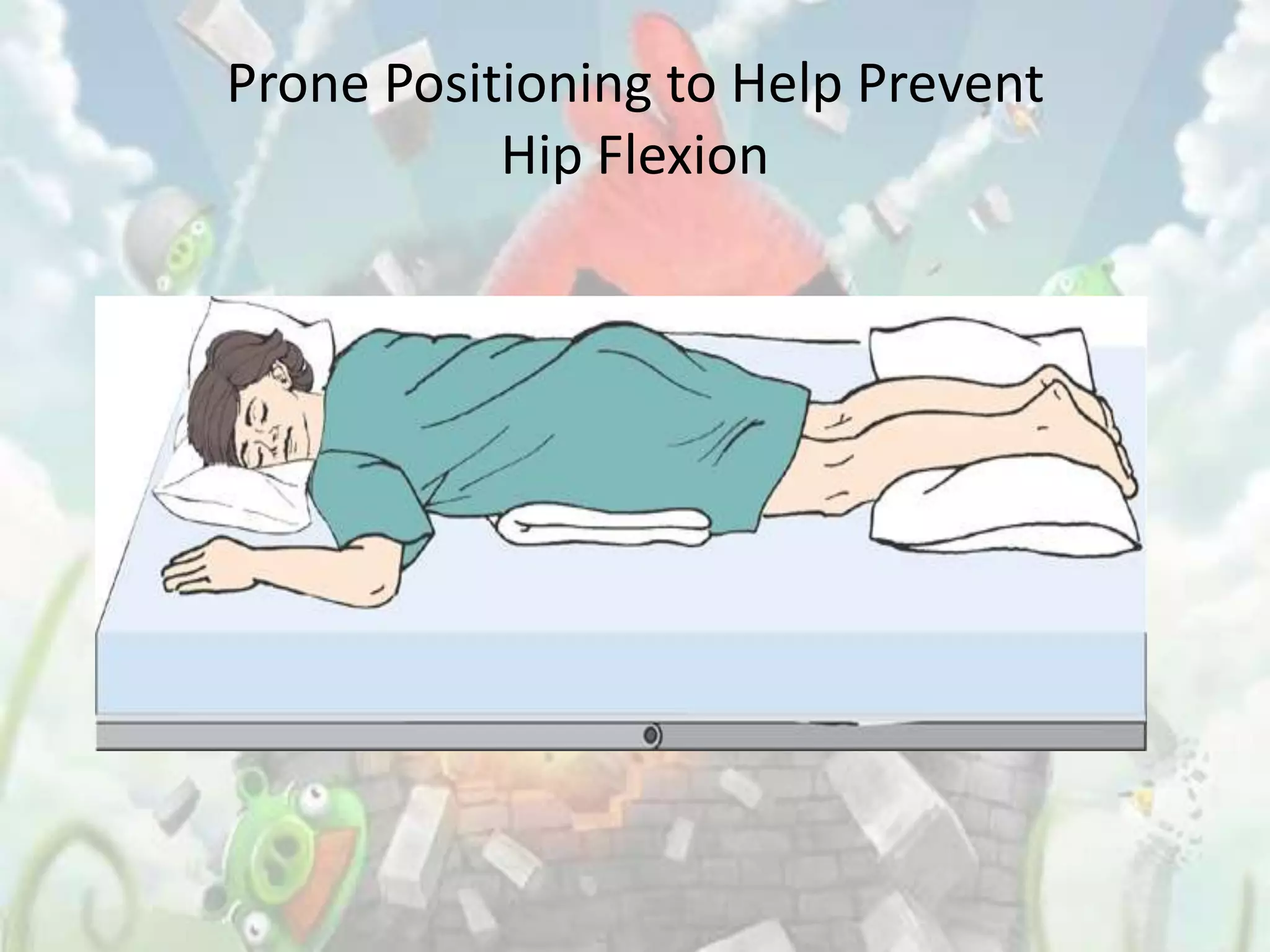Prone Positioning to Help Prevent
           Hip Flexion
 