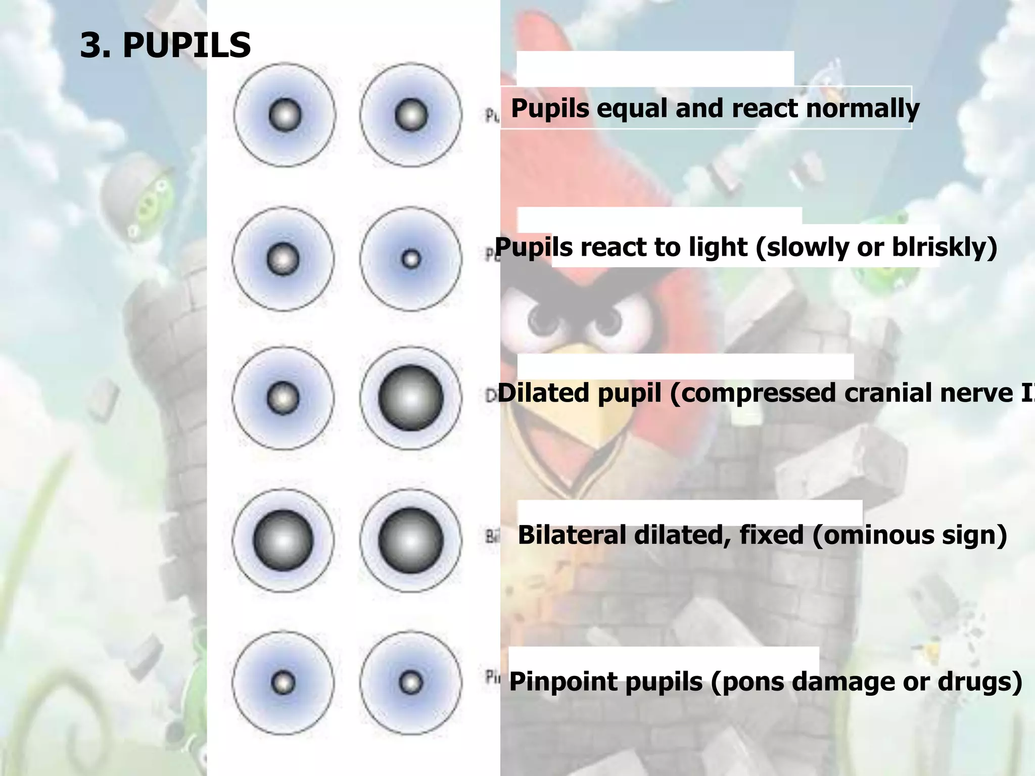 3. PUPILS
             Pupils equal and react normally




            Pupils react to light (slowly or blriskly)




            Dilated pupil (compressed cranial nerve II




             Bilateral dilated, fixed (ominous sign)




             Pinpoint pupils (pons damage or drugs)
 