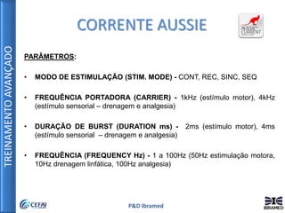 TREINAMENTOAVANÇADO
P&D Ibramed
PARÂMETROS:
• MODO DE ESTIMULAÇÃO (STIM. MODE) - CONT, REC, SINC, SEQ
• FREQUÊNCIA PORTADORA (CARRIER) - 1kHz (estímulo motor), 4kHz
(estímulo sensorial – drenagem e analgesia)
• DURAÇÃO DE BURST (DURATION ms) - 2ms (estímulo motor), 4ms
(estímulo sensorial – drenagem e analgesia)
• FREQUÊNCIA (FREQUENCY Hz) - 1 a 100Hz (50Hz estimulação motora,
10Hz drenagem linfática, 100Hz analgesia)
CORRENTE AUSSIE
 