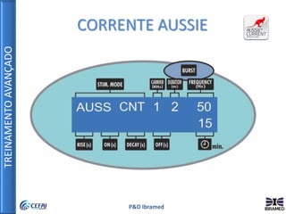 TREINAMENTOAVANÇADO
P&D Ibramed
CORRENTE AUSSIE
 