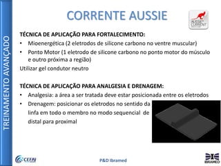 TREINAMENTOAVANÇADO
P&D Ibramed
CORRENTE AUSSIE
TÉCNICA DE APLICAÇÃO PARA FORTALECIMENTO:
• Mioenergética (2 eletrodos de silicone carbono no ventre muscular)
• Ponto Motor (1 eletrodo de silicone carbono no ponto motor do músculo
e outro próxima a região)
Utilizar gel condutor neutro
TÉCNICA DE APLICAÇÃO PARA ANALGESIA E DRENAGEM:
• Analgesia: a área a ser tratada deve estar posicionada entre os eletrodos
• Drenagem: posicionar os eletrodos no sentido da
linfa em todo o membro no modo sequencial de
distal para proximal
 
