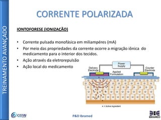 TREINAMENTOAVANÇADO
P&D Ibramed
IONTOFORESE (IONIZAÇÃO)
• Corrente pulsada monofásica em miliampéres (mA)
• Por meio das propriedades da corrente ocorre a migração iônica do
medicamento para o interior dos tecidos.
• Ação através da eletrorepulsão
• Ação local do medicamento
CORRENTE POLARIZADA
 