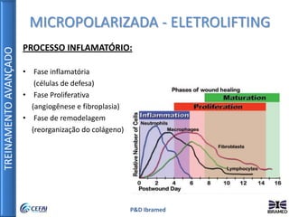 TREINAMENTOAVANÇADO
P&D Ibramed
MICROPOLARIZADA - ELETROLIFTING
PROCESSO INFLAMATÓRIO:
• Fase inflamatória
(células de defesa)
• Fase Proliferativa
(angiogênese e fibroplasia)
• Fase de remodelagem
(reorganização do colágeno)
 