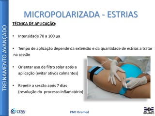 TREINAMENTOAVANÇADO
P&D Ibramed
TÉCNICA DE APLICAÇÃO:
• Intensidade 70 a 100 µa
• Tempo de aplicação depende da extensão e da quantidade de estrias a tratar
na sessão
• Orientar uso de filtro solar após a
aplicação (evitar ativos calmantes)
• Repetir a sessão após 7 dias
(resolução do processo inflamatório)
MICROPOLARIZADA - ESTRIAS
 