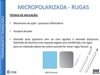 TREINAMENTOAVANÇADO
P&D Ibramed
TÉCNICA DE APLICAÇÃO:
• Mecanismo de ação – processo inflamatório
• Assepsia da pele
• Eletrodo ativo (ponteira sem ou com agulha) e eletrodo dispersivo
(eletrodo de alumínio com esponja vegetal azul umidificada com água
para ser colocado abaixo do ombro quando for tratar rugas faciais)
MICROPOLARIZADA - RUGAS
 