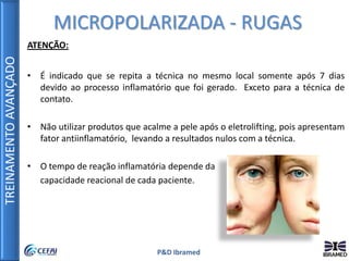 TREINAMENTOAVANÇADO
P&D Ibramed
ATENÇÃO:
• É indicado que se repita a técnica no mesmo local somente após 7 dias
devido ao processo inflamatório que foi gerado. Exceto para a técnica de
contato.
• Não utilizar produtos que acalme a pele após o eletrolifting, pois apresentam
fator antiinflamatório, levando a resultados nulos com a técnica.
• O tempo de reação inflamatória depende da
capacidade reacional de cada paciente.
MICROPOLARIZADA - RUGAS
 