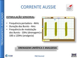TREINAMENTOAVANÇADO
P&D Ibramed
CORRENTE AUSSIE
ESTIMULAÇÃO SENSORIAL:
• Frequência portadora - 4kHz
• Duração dos Bursts - 4ms
• Frequência de modulação
dos Bursts - 10Hz (drenagem) e
100 a 120Hz (analgesia)
DRENAGEM LINFÁTICA E ANALGESIA
 